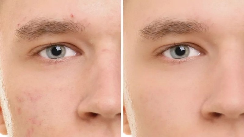 1572333261-e51a5301555ff88